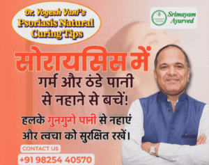 psoriasis treatment Navsari, psoriasis doctor Navsari, psoriasis treatment near Navsari,